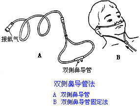◆肺病患者如何家庭氧療？